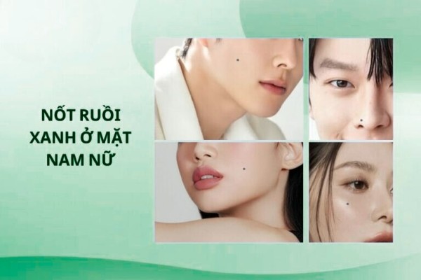 Nốt ruồi màu xanh ở mặt là nốt ruồi may mắn, đừng xóa bỏ