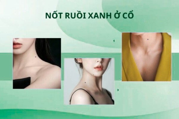 Người có nốt ruồi màu xanh dương ở cổ không có nhiều mối quan hệ thân thiết