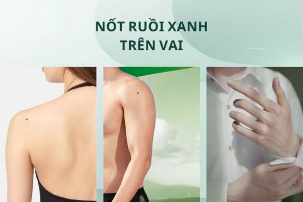 Nốt ruồi màu xanh trên vai – Khổ ải trăm bề