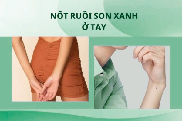 Nốt ruồi xanh ở tay trái hay tay phải đều mang ý nghĩa không tốt cho chủ nhân