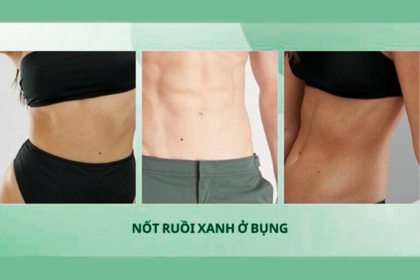 Nốt ruồi xanh ở bụng – Người sống nội tâm, bi quan