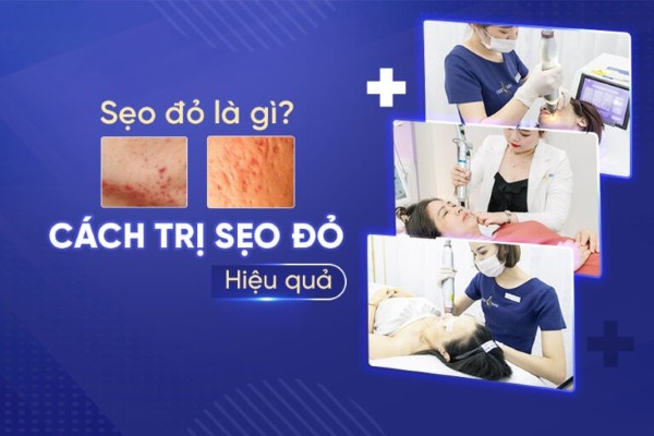 Sẹo đỏ sau mụn là gì? Sẹo thâm đỏ có tự hết không?