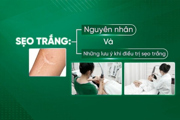 Sẹo trắng là gì? Nguyên nhân và cách phòng ngừa hiệu quả