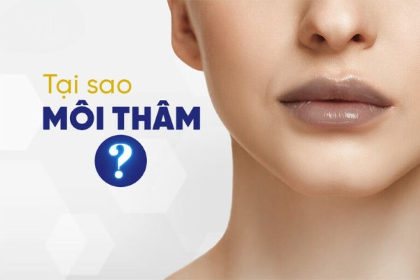 Tại sao môi thâm? 9 Nguyên nhân gây thâm môi và cách xử lý