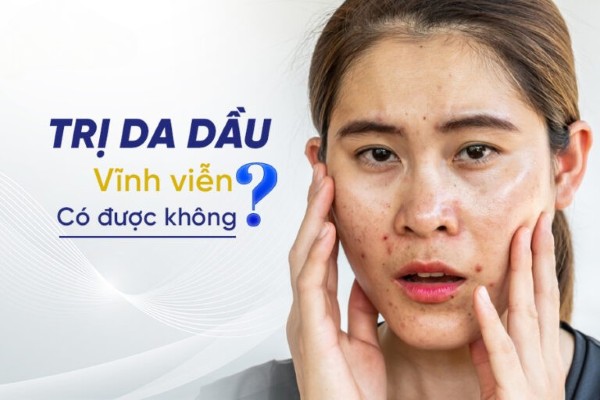 Trị da dầu vĩnh viễn có được không? Theo dõi ngay