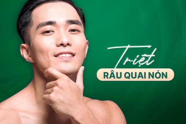 10 Cách triệt râu quai nón cấp tốc và cẩm nang chăm sóc sau khi triệt