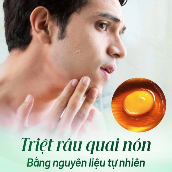 Triệt râu quai nón bằng lòng trắng trứng gà