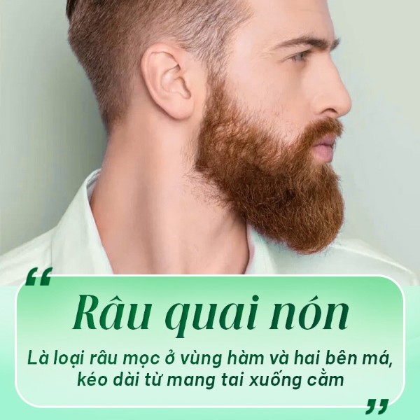 Râu quai nón là gì?