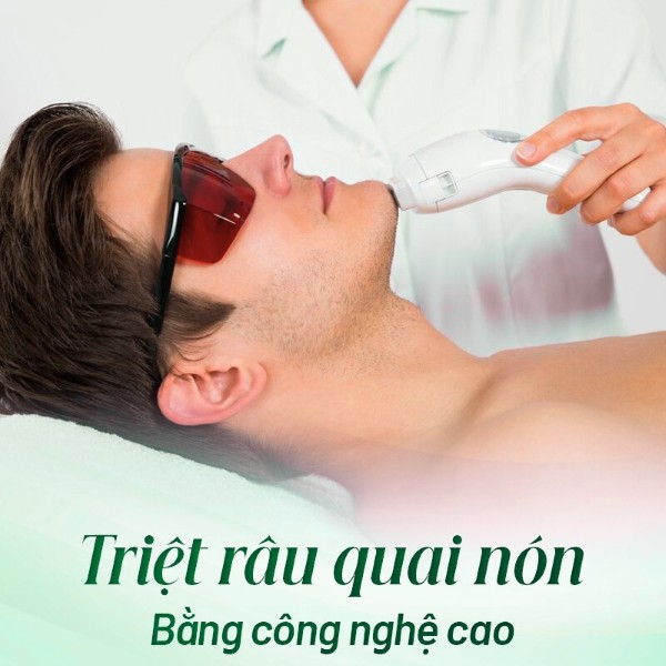 Triệt râu quai nón bằng công nghệ cao