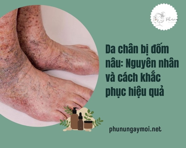 da chân bị đốm nâu