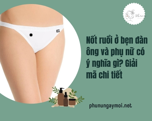 Nốt ruồi ở bẹn
