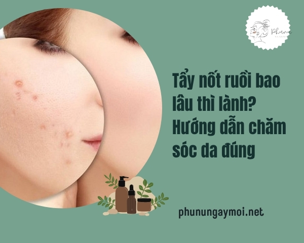 Tẩy nốt ruồi bao lâu thì lành