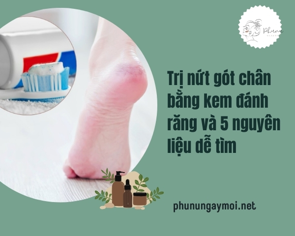 Trị nứt gót chân bằng kem đánh răng