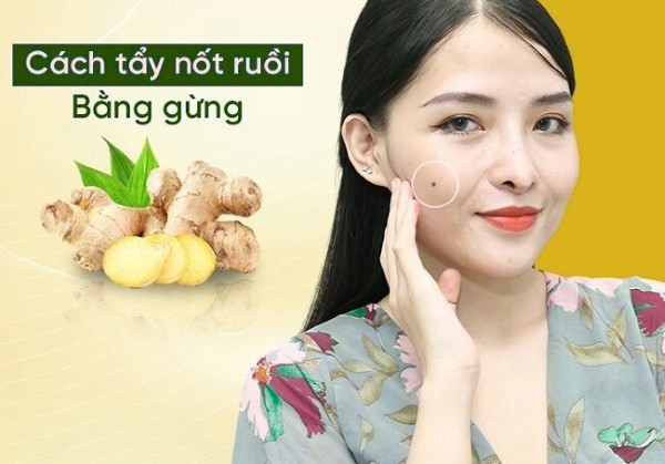 Cách tẩy nốt ruồi bằng gừng tươi: Hiệu quả và mức độ an toàn