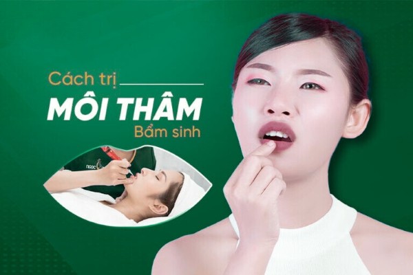 10 Cách trị môi thâm bẩm sinh nhanh, hiệu quả, ít tốn công