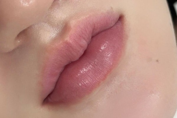 Môi thâm bẩm sinh chủ yếu do gen di truyền kết hợp với chăm sóc, cách trị môi thâm bẩm sinh chưa phù hợp