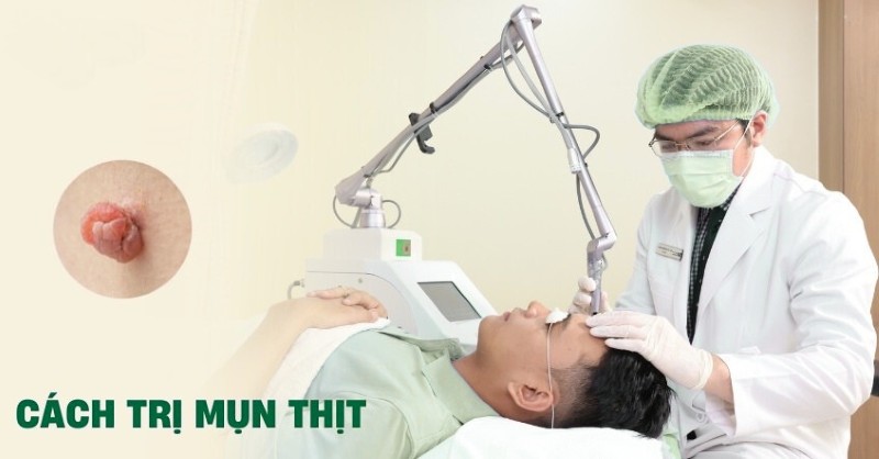 Cách trị mụn thịt tận gốc tại nhà hiệu quả và an toàn