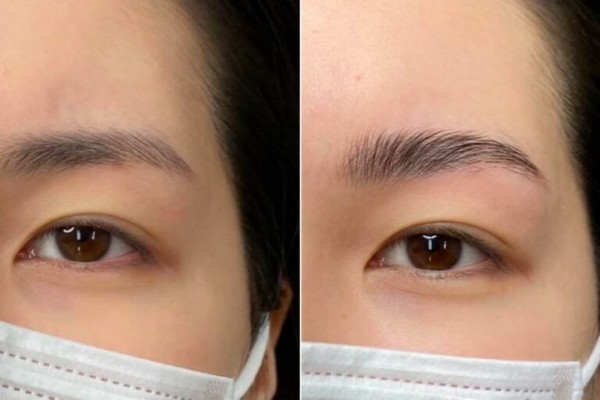 Cơ địa mẹ bầu dễ dị ứng với mực xăm