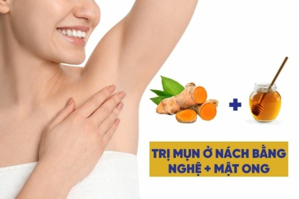 Curcumin trong nghệ sẽ cung cấp khả năng kháng khuẩn, ức chế sự lây lan của vi khuẩn gây mụn và giảm sưng viêm