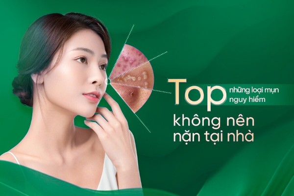 TOP những loại mụn nguy hiểm tuyệt đối không nên tự nặn tại nhà