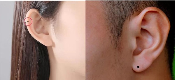 Cách nhận biết nốt ruồi ở tai có hướng tốt hay xấu?
