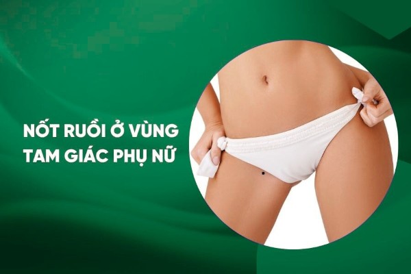 Nốt ruồi ở vùng tam giác phụ nữ có ý nghĩa gì? Có phải tướng quý?