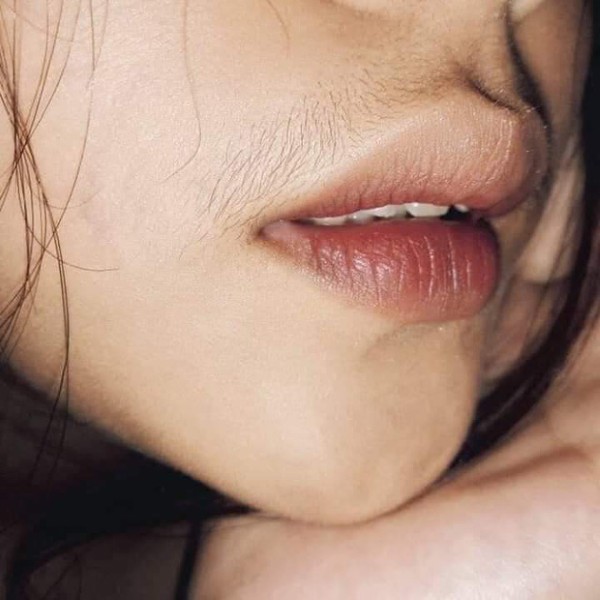 Ria mép con gái do rối loạn tuyến thượng thận