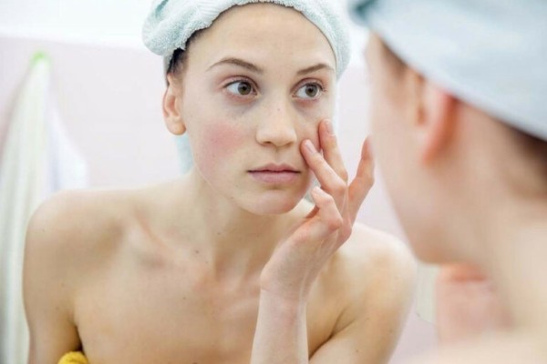 Xuất hiện rủi ro dị ứng là một trong những tác hại của nha đam với da mặt phổ biến nhất Xuất hiện rủi ro dị ứng là một trong những tác hại của nha đam với da mặt phổ biến nhất