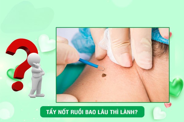 Tẩy nốt ruồi bao lâu thì lành? Hướng dẫn chăm sóc da đúng