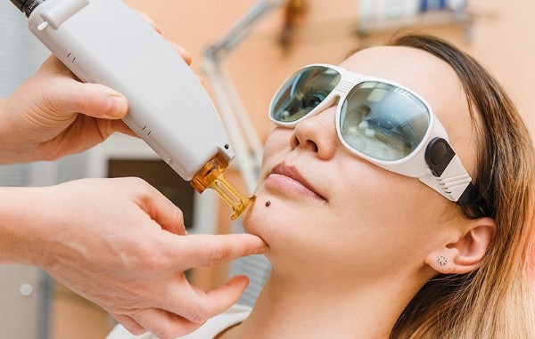 Nên lựa chọn địa chỉ, cơ sở làm đẹp uy tín để hạn chế tình trạng da bị sẹo sau khi tẩy nốt ruồi