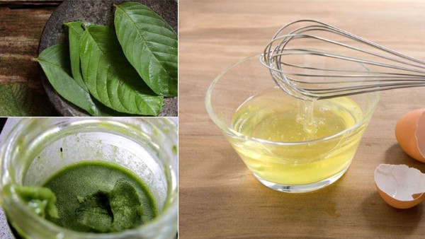 Cách trị nám bằng lá ổi và lòng trắng trứng gà Cách trị nám bằng lá ổi và lòng trắng trứng gà