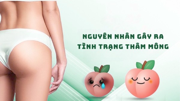 Nguyên nhân gây ra tình trạng thâm mông