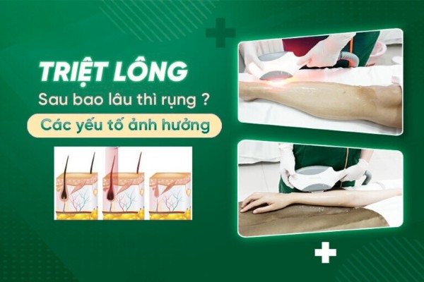 Triệt lông sau bao lâu thì rụng? Những yếu tố ảnh hưởng
