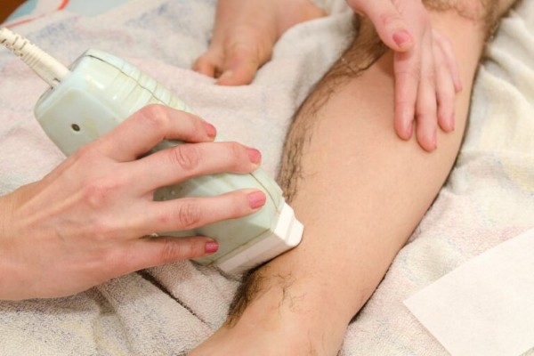 Việc triệt lông bao lâu mọc lại còn phụ thuộc vào nhiều yếu tố khác nhau