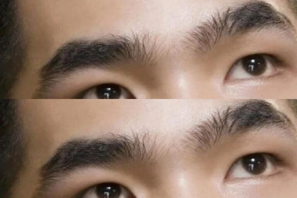 Tướng mày che khuất ấn đường – Đường tài lộc suy yếu