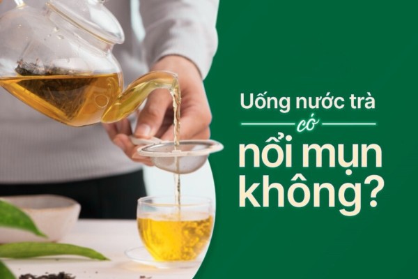 Uống trà có nổi mụn không? Top các loại trà tốt cho da mụn