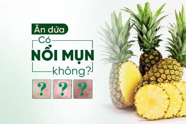 Ăn dứa có nổi mụn không? Lời khuyên cho làn da mụn Ăn dứa có nổi mụn không? Lời khuyên cho làn da mụn