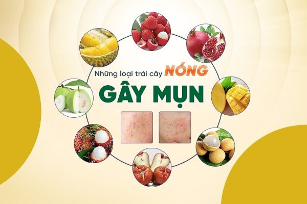 Các loại trái cây dễ gây nóng và nổi mụn cần lưu ý