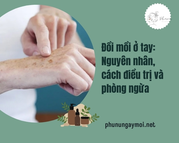 đồi mồi trên tay