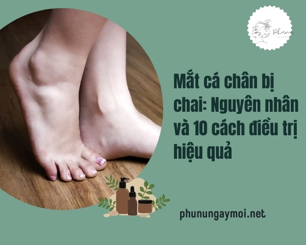 Mắt cá chân bị chai