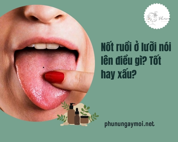 Nốt ruồi ở lưỡi