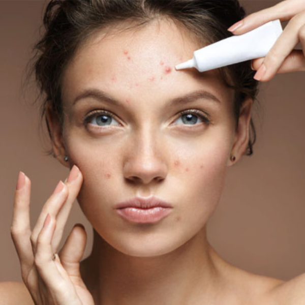 Điều trị break out mụn theo phác đồ y khoa