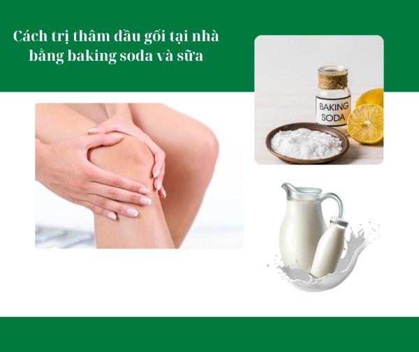 Cách trị thâm đầu gối tại nhà bằng baking soda và sữa