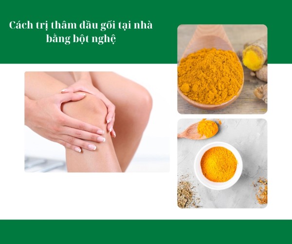Cách trị thâm đầu gối tại nhà bằng bột nghệ