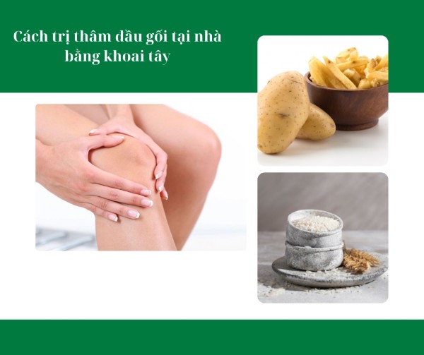 Cách trị thâm đầu gối tại nhà bằng khoai tây