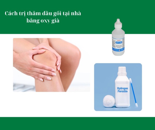 Cách trị thâm đầu gối tại nhà bằng oxy già