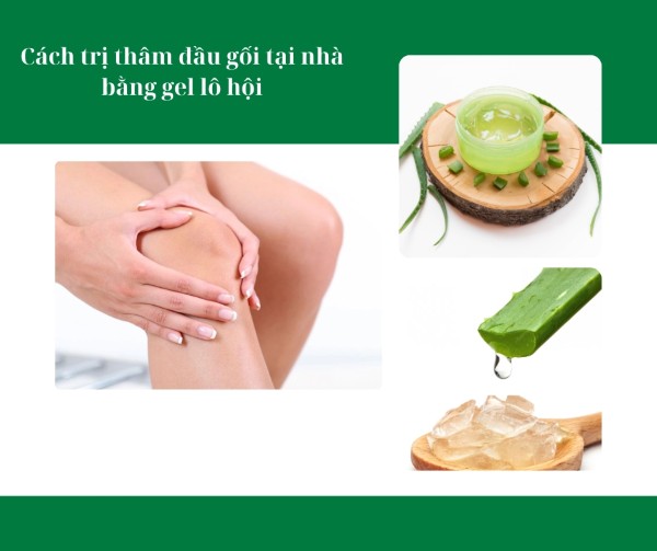 Cách trị thâm đầu gối tại nhà bằng gel lô hội