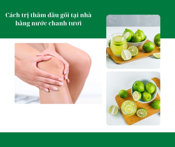 Cách trị thâm đầu gối tại nhà bằng nước chanh tươi
