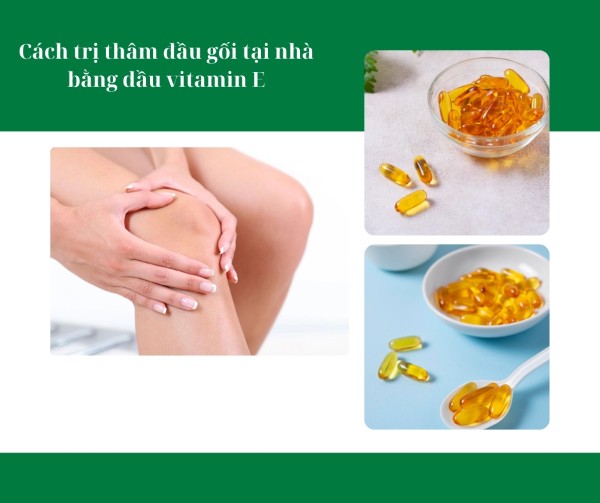 Cách trị thâm đầu gối tại nhà bằng dầu vitamin E