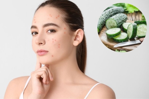Dưa chuột có khả năng cung cấp độ ẩm tự nhiên cho da